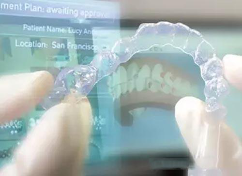 上海數(shù)造牙模3D打印機推薦打印案例